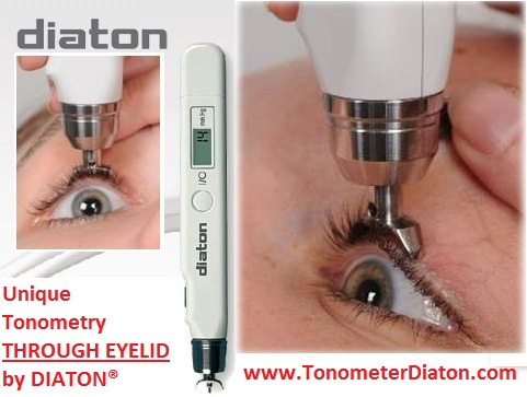 Diaton tonometer