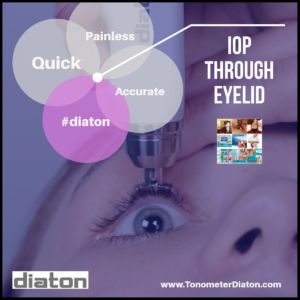 Eye Tonometer Diaton