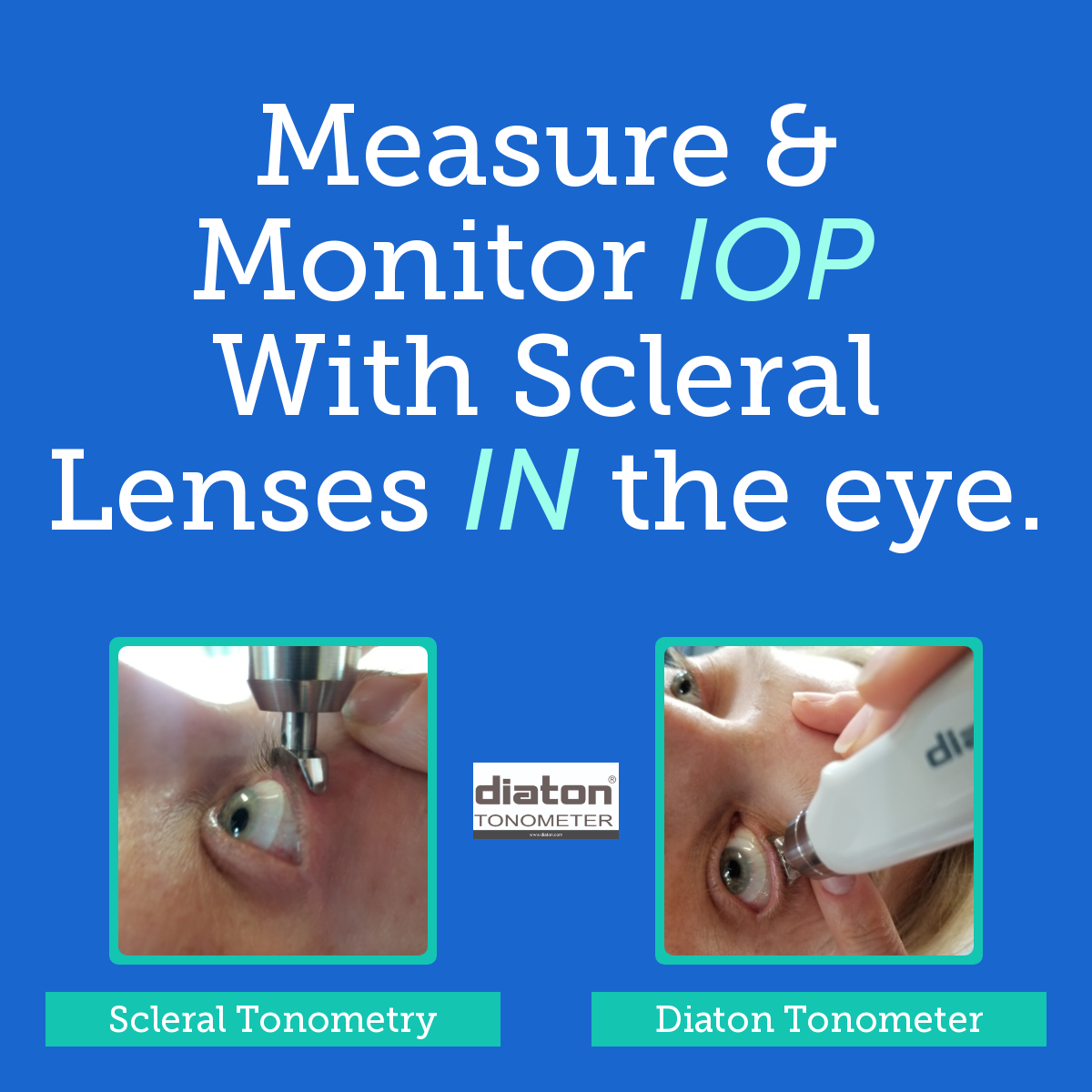 Diaton Tonometer Vision Expo Scleral Lenses