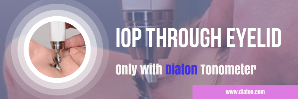 diaton tonometer iop through eyelid