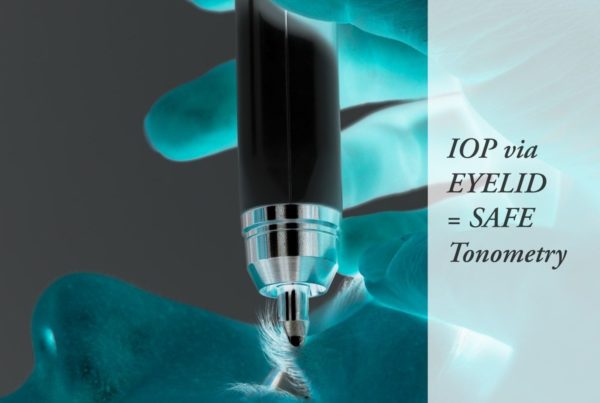 tonometry through eyelid with diaton tonometer