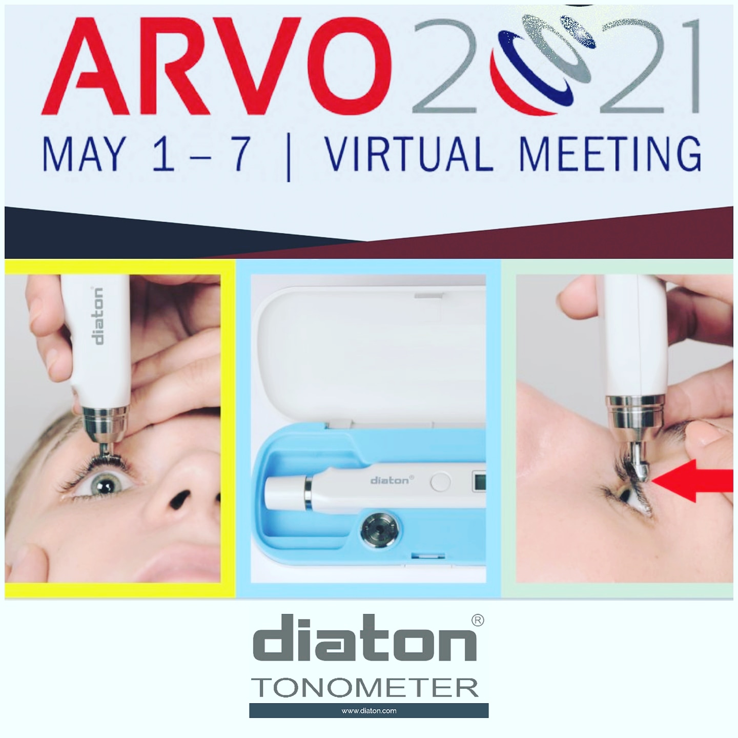 Unique Transpalpebral & Scleral Diaton tonometer at ARVO 2021 Virtual Meeting