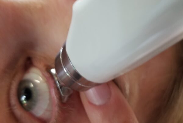 diaton tonometer used on the eye with scleral lenses to measure intraocular pressure