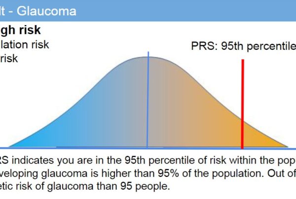 glaucoma statistics