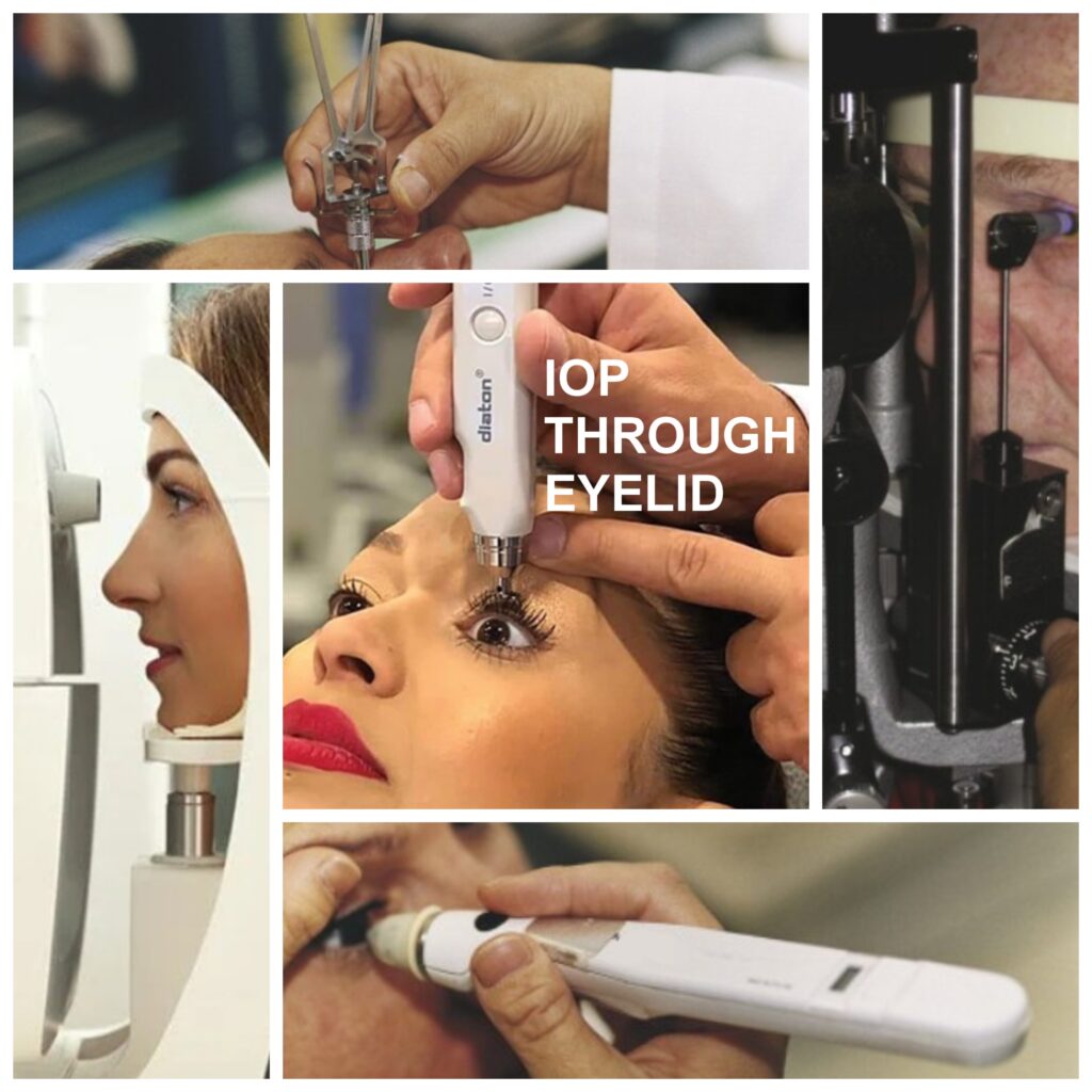 Diaton Tonometer IOP through eyelid for glaucoma screening detection diagnostics