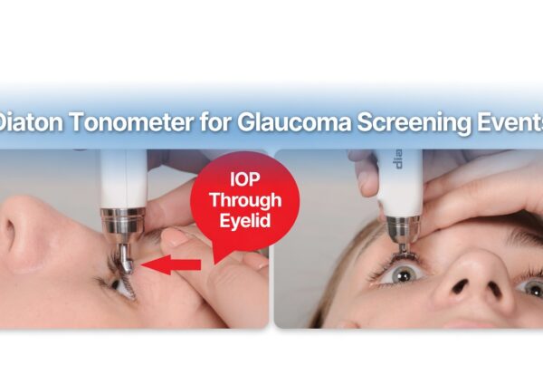 Diaton tonometer for glaucoma screening events